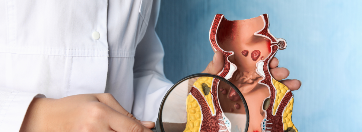 Anal Fistül Nedir? Teşhis ve Tanı Yöntemleri Nelerdir?