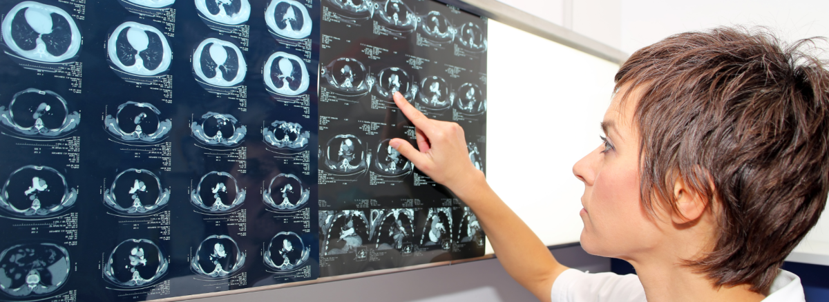 Akciğer Embolisi Nedir? Teşhis ve Tanı Yöntemleri Nelerdir?