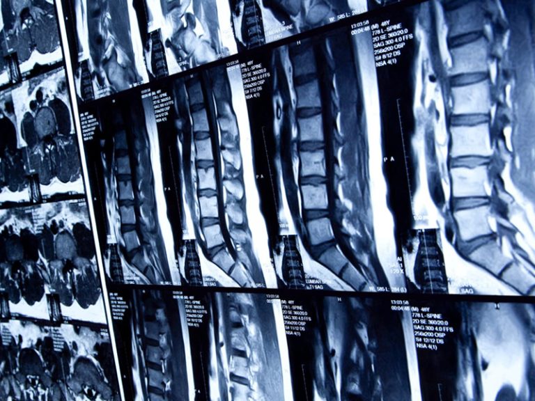 Bel MRI