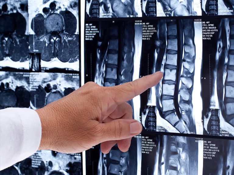 Lomber MRI