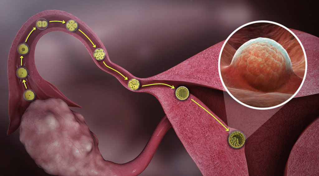 Fallop Tüpü Tıkanıklığı Nedir? Tanı Yöntemleri Nelerdir? - Prof. Dr ...