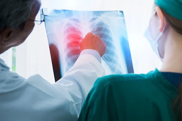 Akciğer Tomografisi