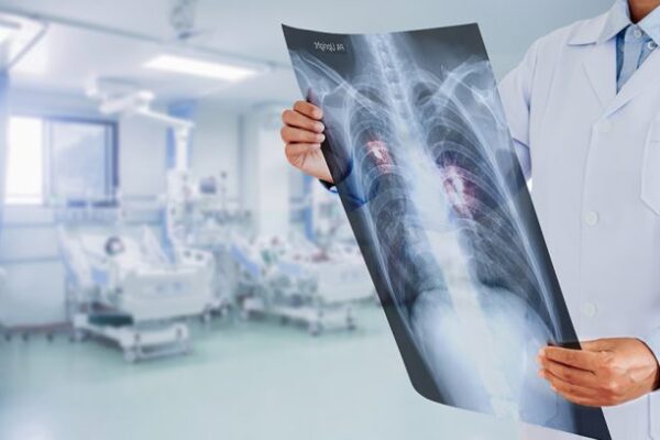 Akciğer Tomografisi (Toraks BT)