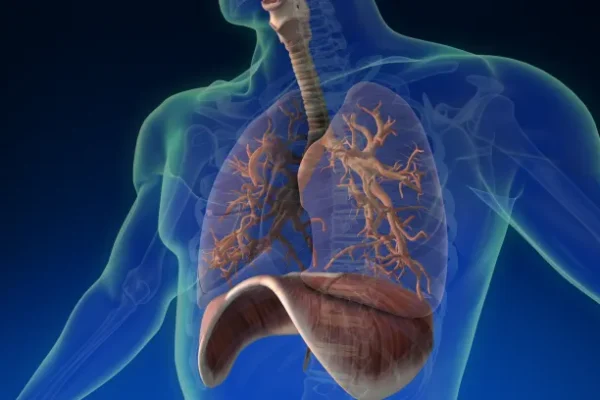 Akciğerde Sıvı Birikmesi (Plevral Efüzyon) Nedir? Teşhisi Nasıl Yapılır?