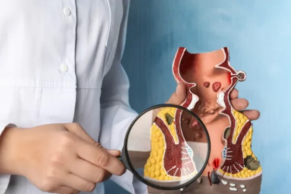 Anal Fistül Nedir? Teşhis ve Tanı Yöntemleri Nelerdir?