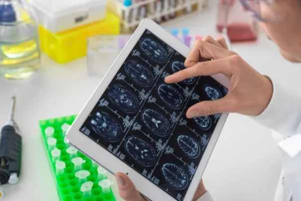 Atrofi Nedir? Tanı ve Teşhis Yöntemleri Nelerdir?