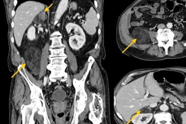 Batın Emarı (Batın MR)
