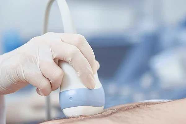 Abdominal Ultrasound