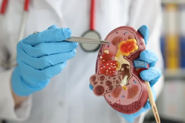 Böbrek Büyümesi (Hidronefroz) Nedir? Tanı Yöntemleri Nelerdir?