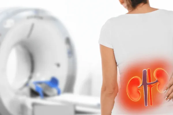 Böbrek Tomografisi (Renal BT)