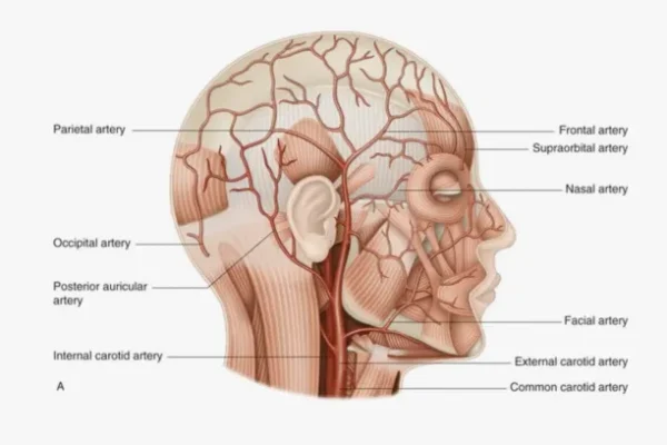 Temporal Arterit Nedir?