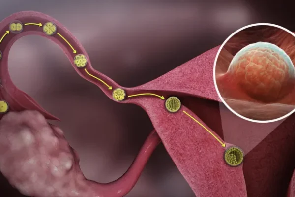 Fallop Tüpü Tıkanıklığı Nedir? Tanı Yöntemleri Nelerdir?