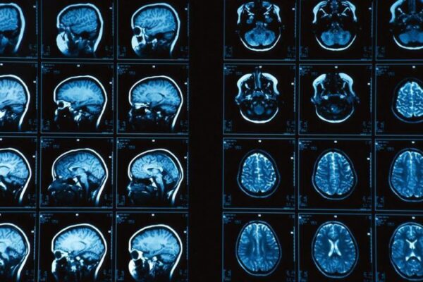 Fonksiyonel Emar (Fonksiyonel MR)