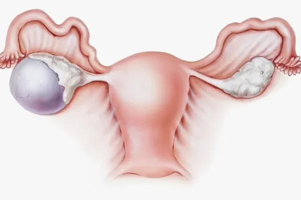 Hepatik Kist Nedir? Tanı Yöntemleri Nelerdir?