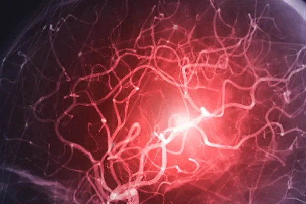 MR Anjiyografi ile MR Arasındaki Farklar Nelerdir?