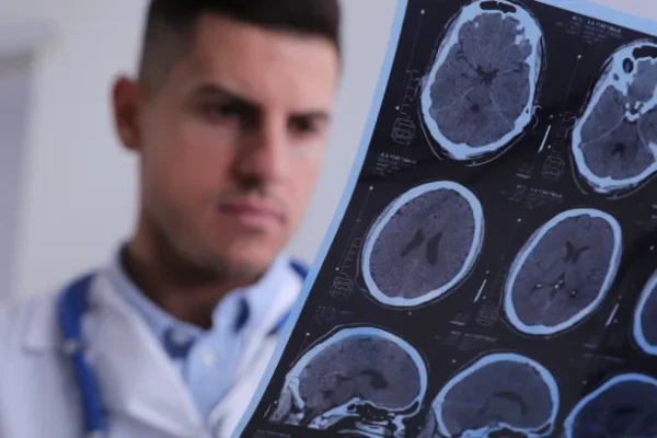 Multipl Skleroz (MS Hastalığı) Nedir? Nasıl Teşhis Edilir?