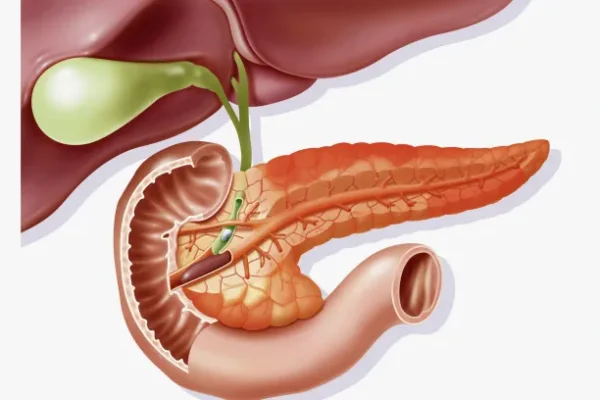 Pankreatit Nedir?