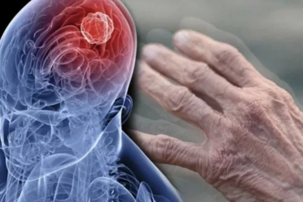 Parkinson Nedir? Tanı Yöntemleri Nelerdir?