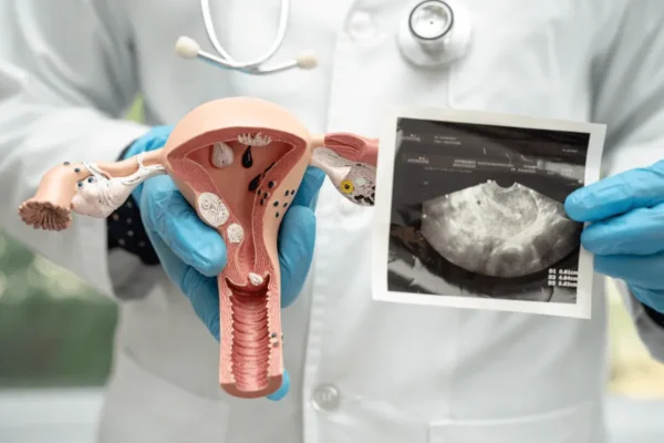 Rahim Yumurtalık Ultrasonu (Pelvik Ultrason)