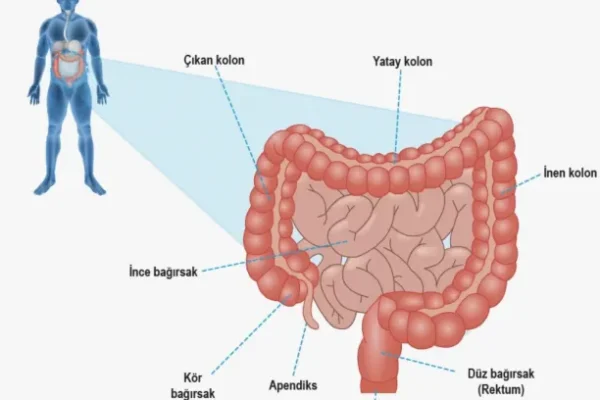 Rektosel (Bağırsak Fıtığı) Nedir?