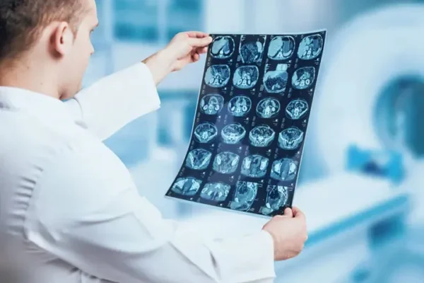 Tüm Vücut Difüzyon MR