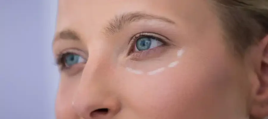 Göz Altı Işık Dolgusu