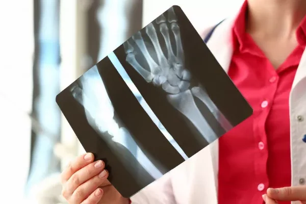 Bone Biopsy